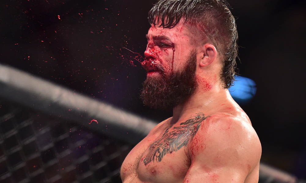 Mike Perry assaulted